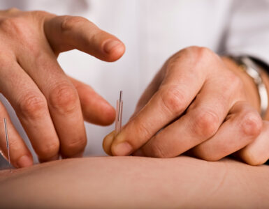 - suor excessivo Veja como adotar a acupuntura para emagrecer